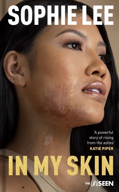 In My Skin - Re-vived